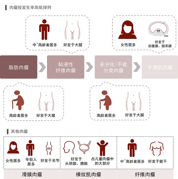 /images/2021/04/27/繊維肉腫.jpg 繊維肉腫.jpg