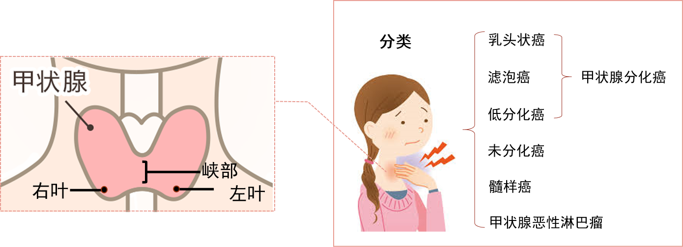 /images/2021/04/15/甲状腺11.png